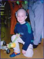 Robin whrend der Chemo-Therapie 1999